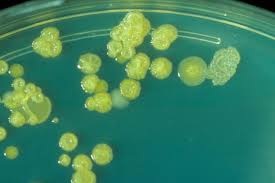 Các phương pháp phát hiện và nhận dạng Cronobacter sakazakii