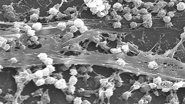 Tác dụng kháng biofilm của hạt nano polymer bọc α-mangostin lên vi khuẩn gây bệnh