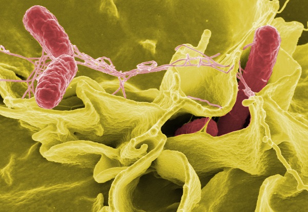 Hình ảnh vi khuẩn Salmonella