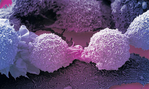 Tế bào ung thư ngừng phân chia khi được các hà khoa học đưa bộ hãm phanh vào. Ảnh: Wellcome Collection